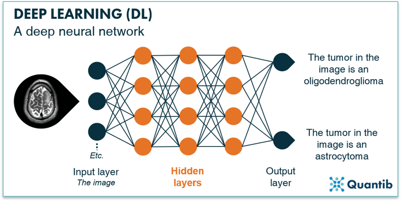 Infographic explaning a deep neural network using a brain MRI as an example