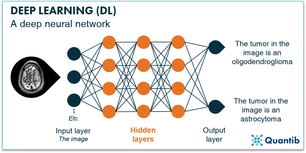 Deep network