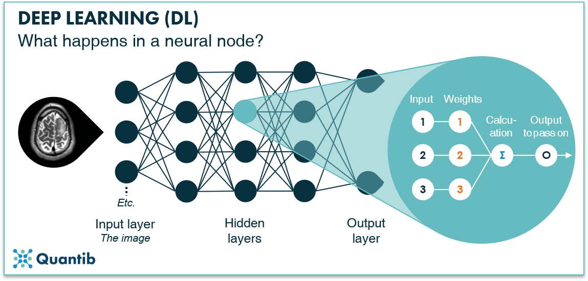 schematic figure illustrating deep learning in radiology explaining what happens in a neural node
