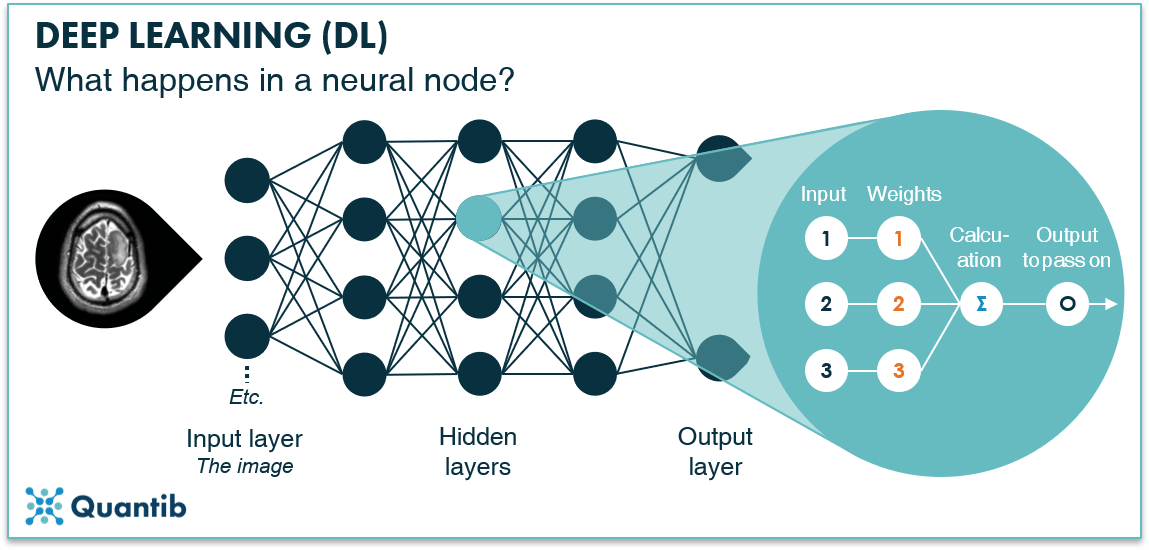 Infographic explaning a machine learning neural node using a brain MRI as an example