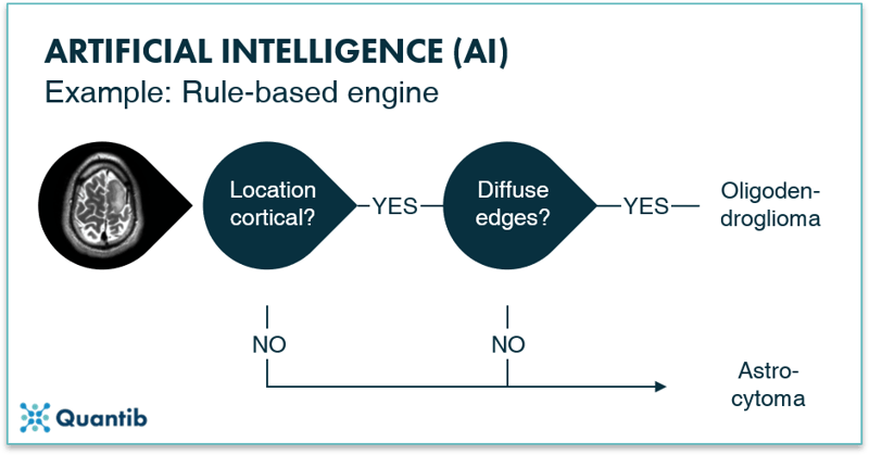 Infographic explaning the artificial intelligence algorithm of a rule-based engine using a brain MRI