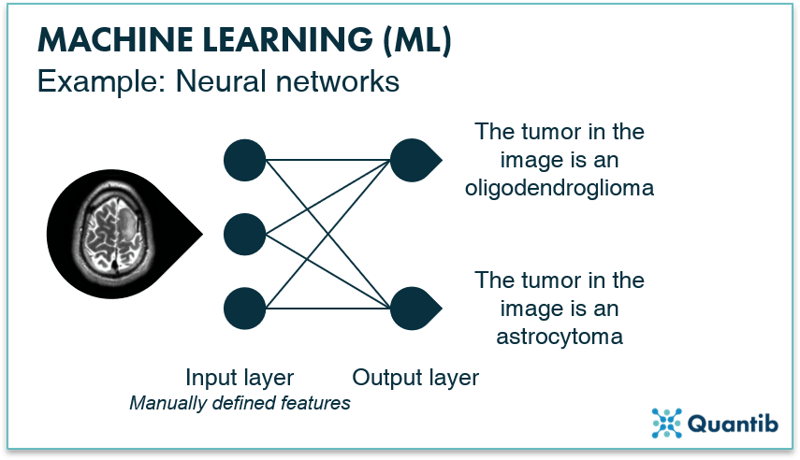 Infographic explaning a machine learning neural network using a brain MRI as an example