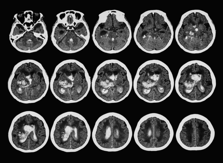 overview of brain CTA scans consisting of multiple slices