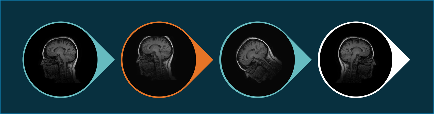 Augmentation blog header - AI in radiology - Quantib