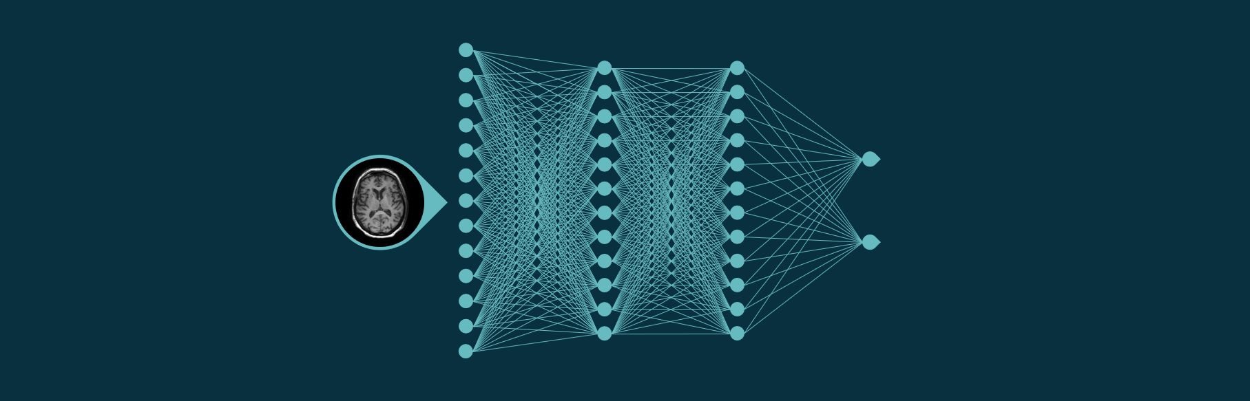 Deep learning in radiology neural network
